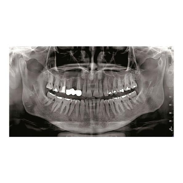 Instalatie radiologica NewTom GO 2D/3D - imagine 5