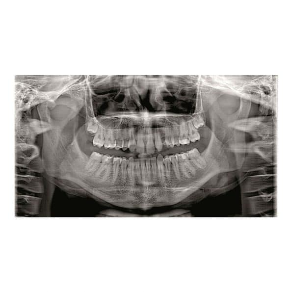 Instalatie radiologica NewTom GO 2D/3D - imagine 6