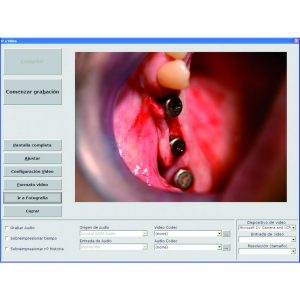 Digital soft Optomic