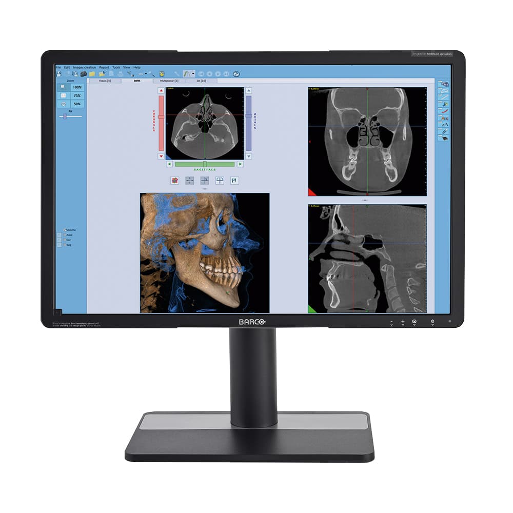 NewTom Giano HR instalatie radiologica imagini clare