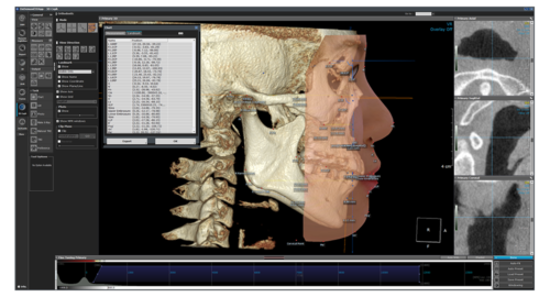 halmadent-OnDemand3D_modul_3D-Ceph Modul 3DCeph - Software OnDemand3D