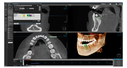 halmadent-OnDemand3D_modul_3D Modul 3D - Software OnDemand3D