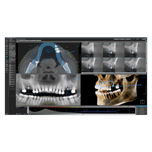 Modul DVR - Software OnDemand3D