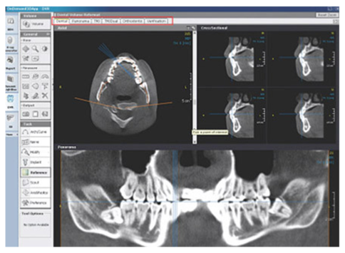 halmadent-OnDemand3D_modul_Dental Modul Dental - Software OnDemand3D