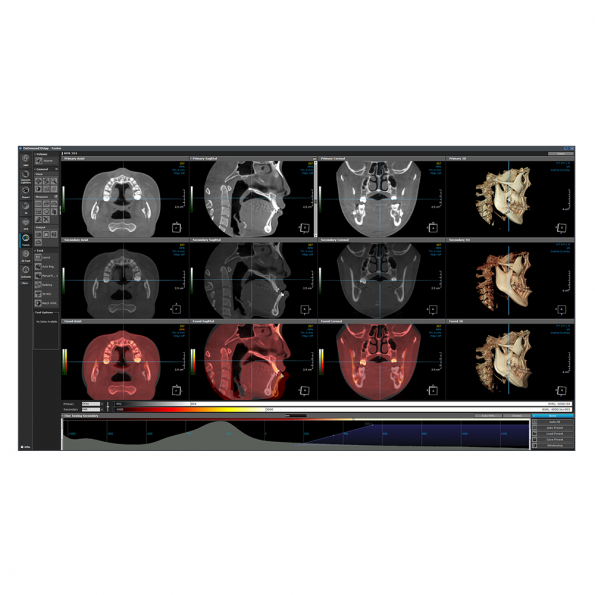 Modul Fusion - Software OnDemand3D