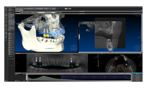 halmadent-OnDemand3D_modul_In2Guide Modul In2Guide - Software OnDemand3D