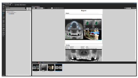 halmadent-OnDemand3D_modul_Report Modul Report - Software OnDemand3D