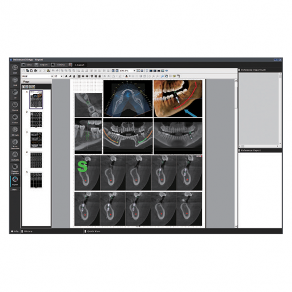 Modul X-Report - Software OnDemand3D