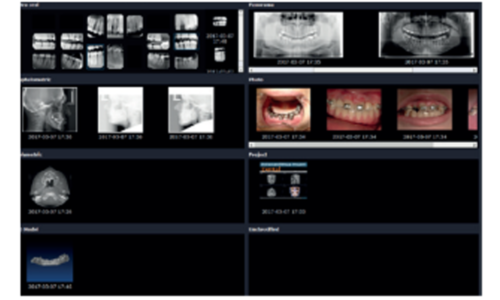 halmadent-OnDemand3D_modul_XImage Modul XImage - Software OnDemand3D