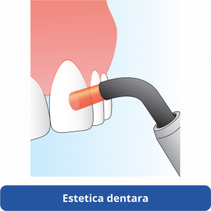 halmadent elexxion estetica dentara laser