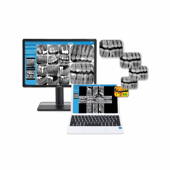 Pachet NewTom scanner digital X-PSP cu instalatie intraorala RXDC, telecomanda cu fir - imagine 5