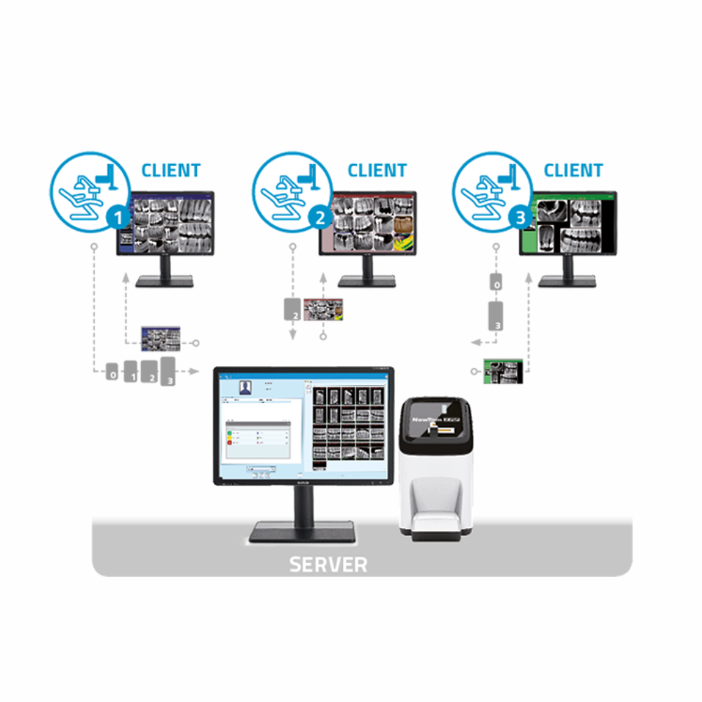Scanner digital cu placi fosforice NewTom X-PSP
