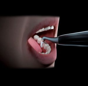 Detartraj si Profilaxie 2 in 1 AP-H DTE