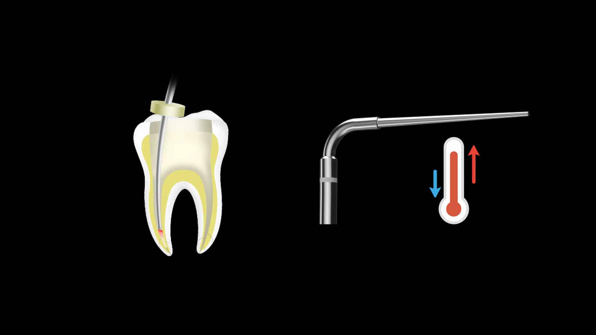 Halmadent-Fi-P DTE Woodpecker guttapercha vágórendszer