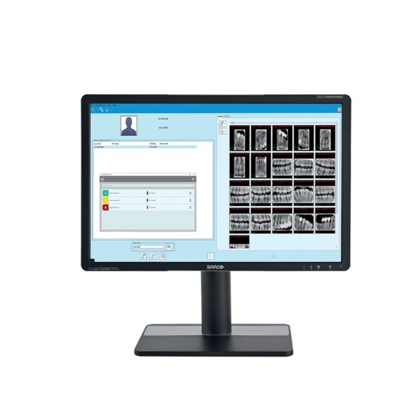 Pachet NewTom senzor digital USB DCiS size 2 cu instalatie intraorala RXDC, telecomanda fara fir, mobil - imagine 8